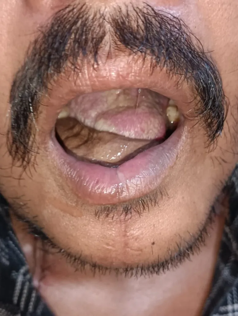 Before surgery