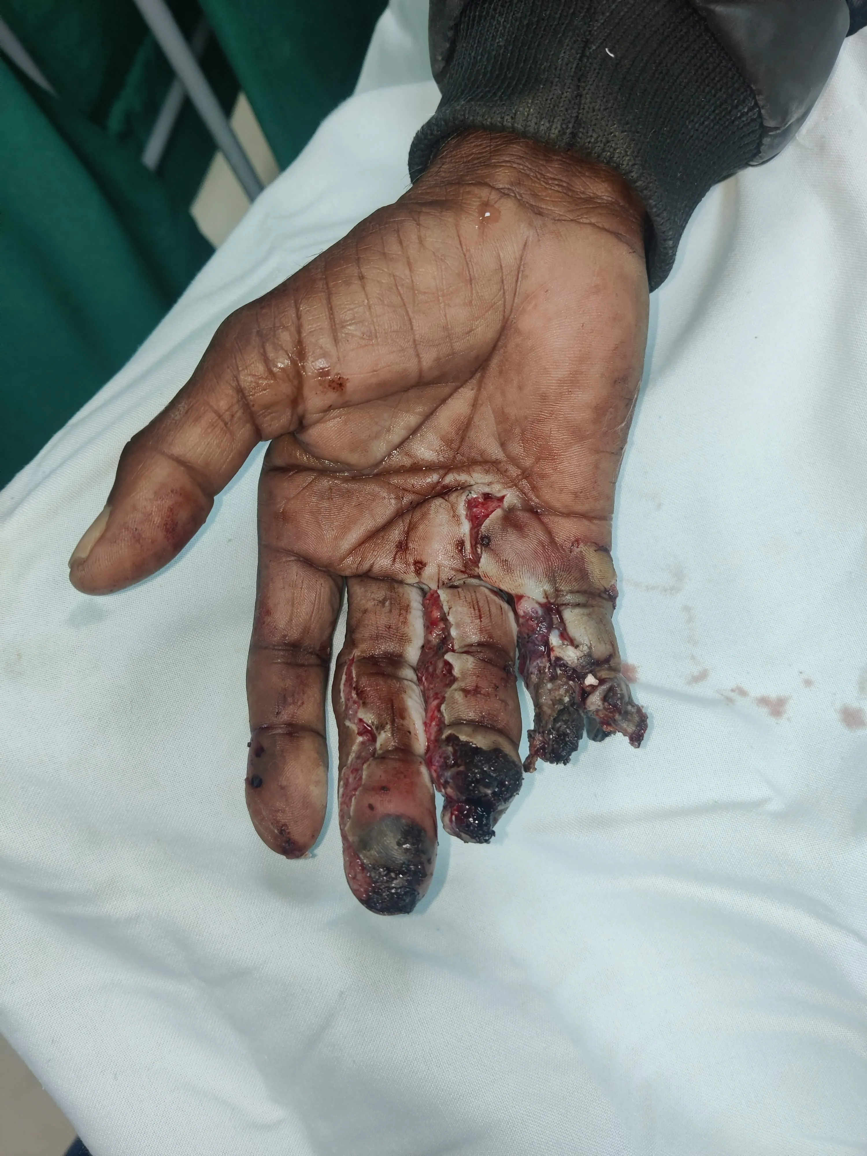 Before surgery