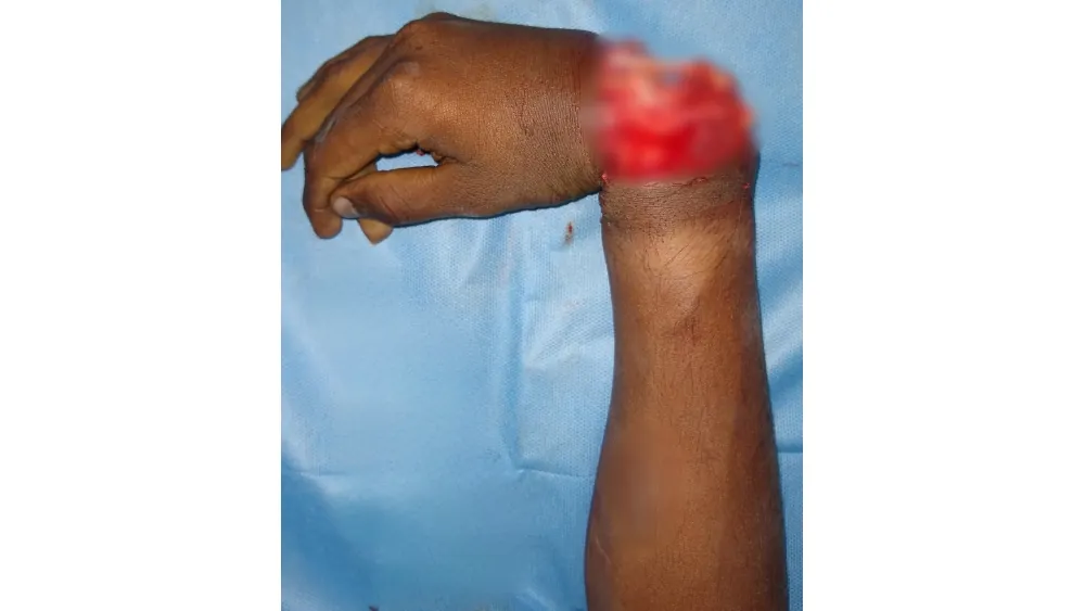 Before surgery