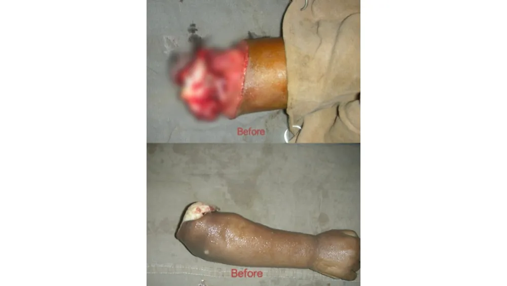 Before surgery