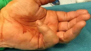 Before surgery
