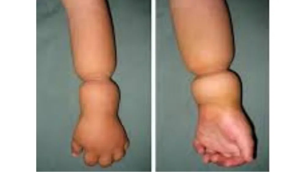 Before surgery