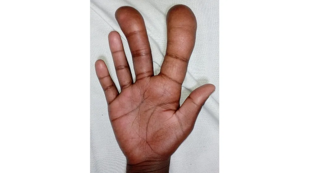 Before surgery