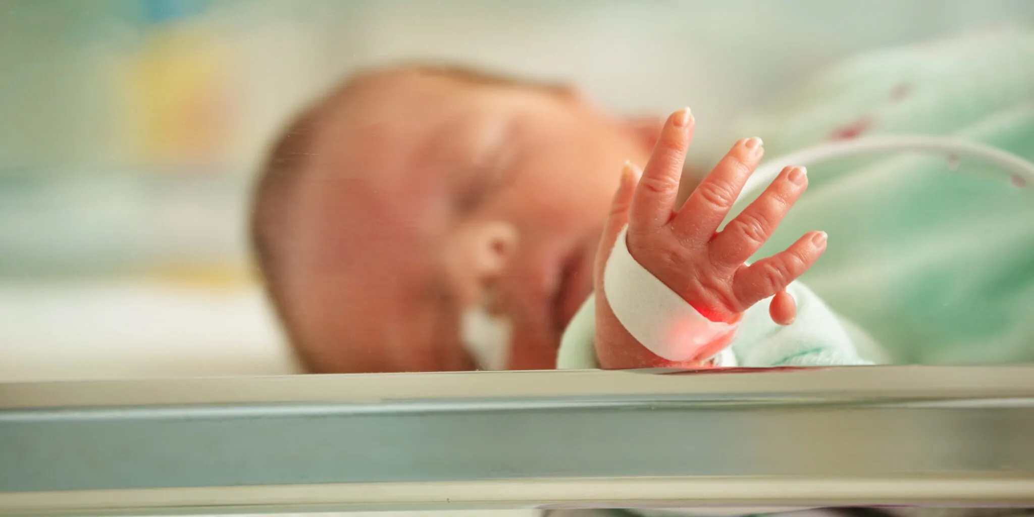 Polydactyly (Extra Fingers in Children) — hero image