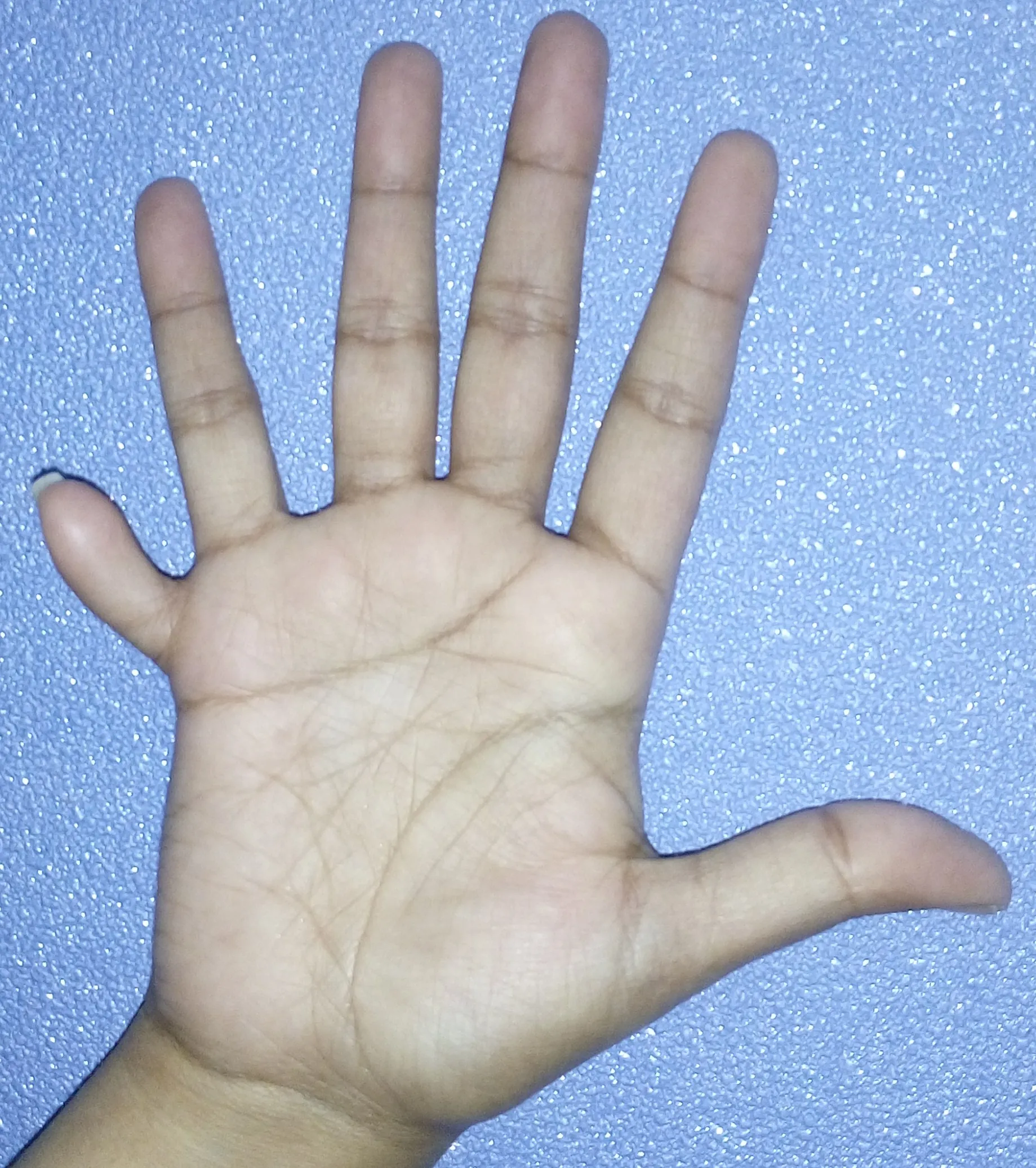 Before surgery