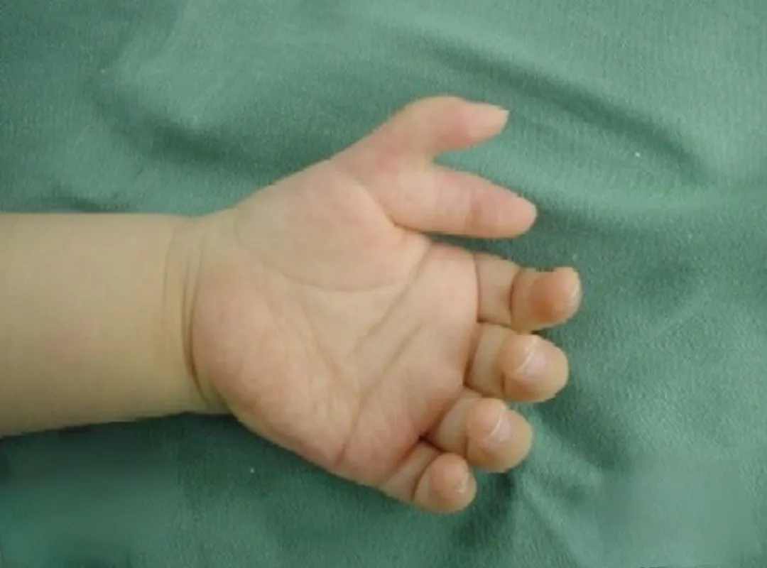 Before surgery