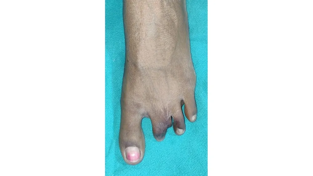 Before surgery