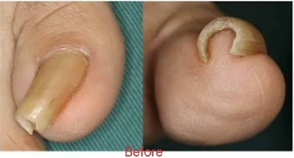 Before surgery