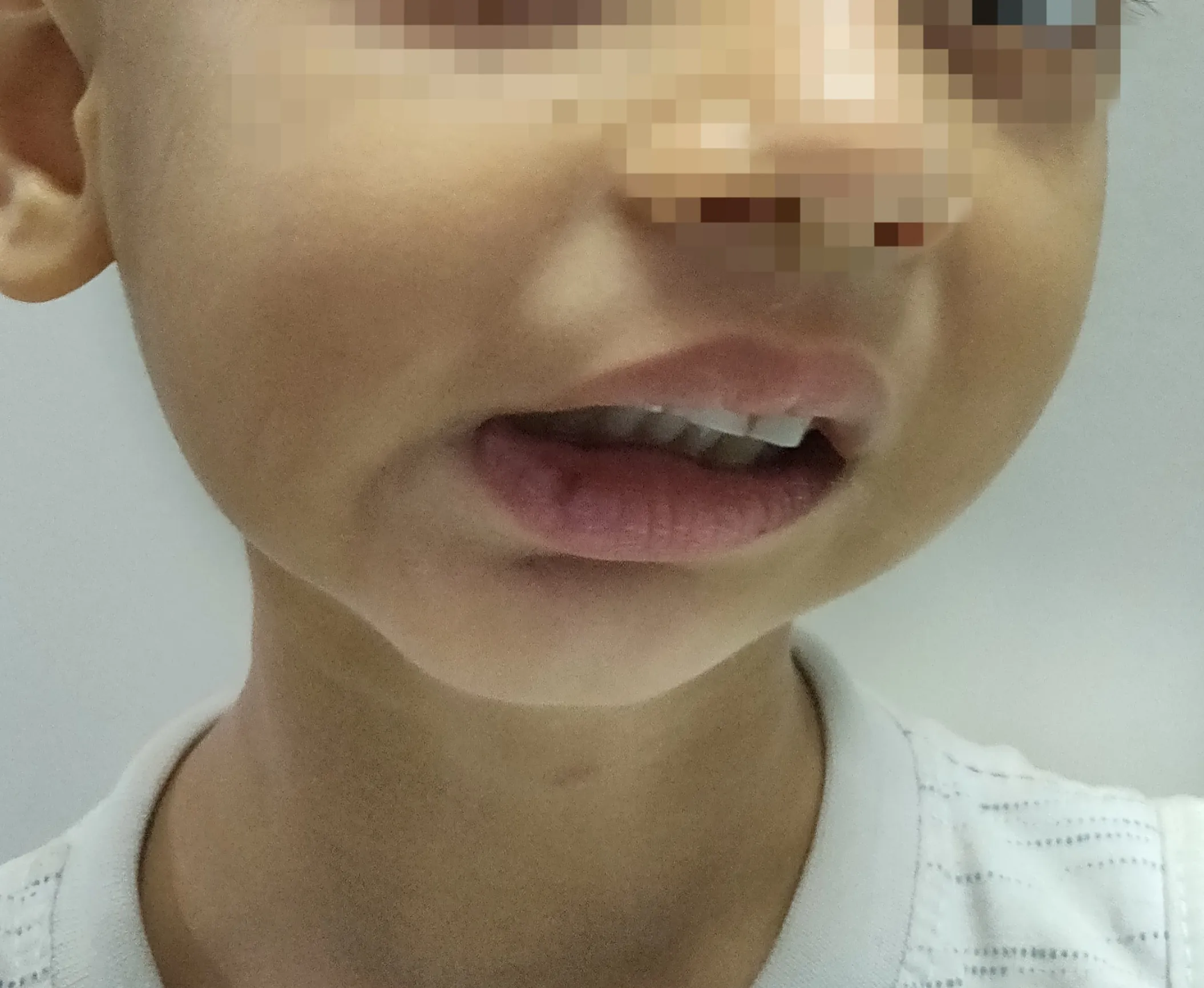 Before surgery