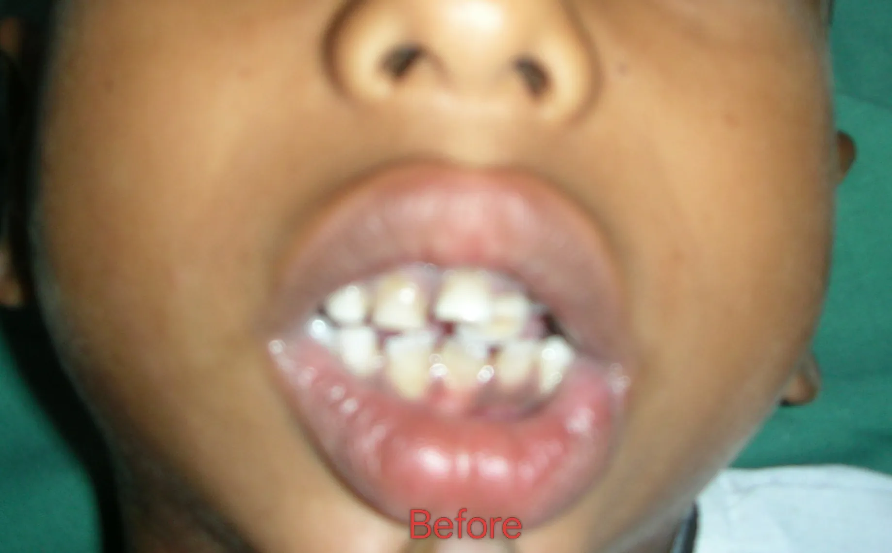 Before surgery