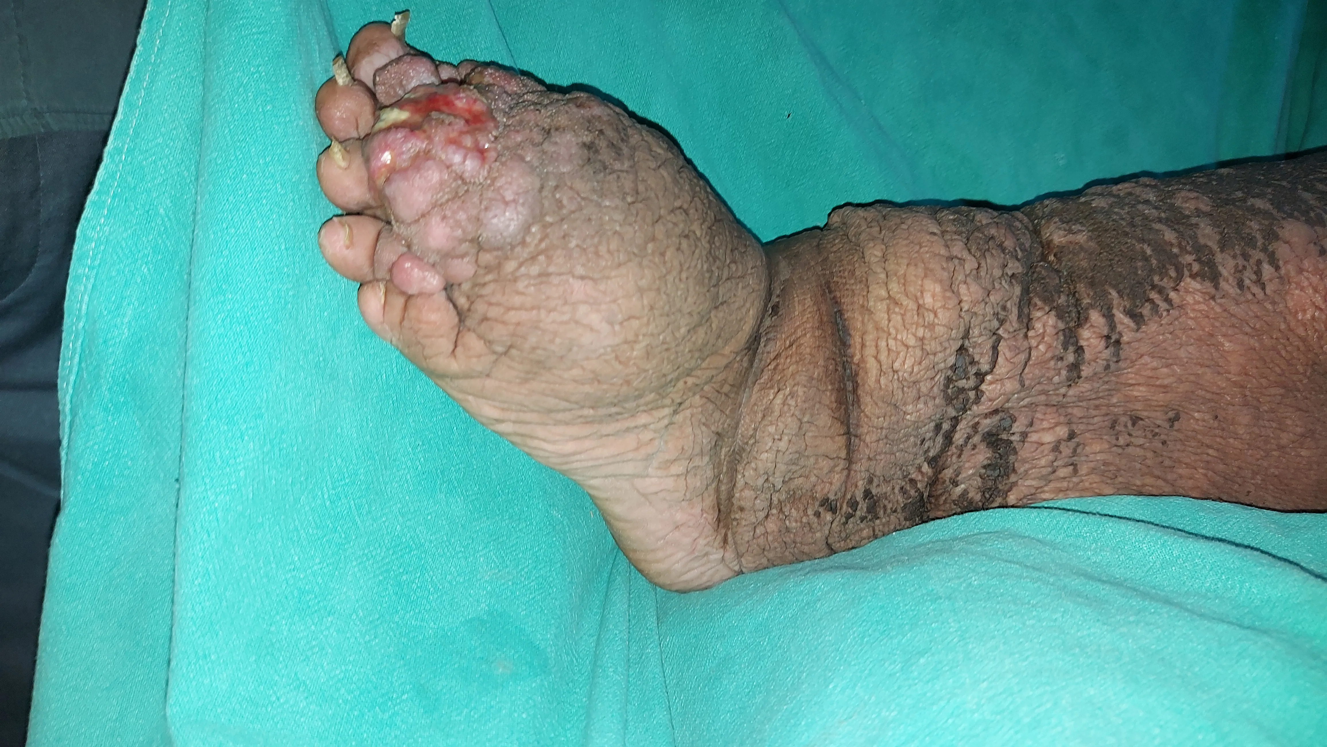 Before surgery
