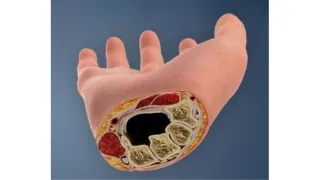 After surgery