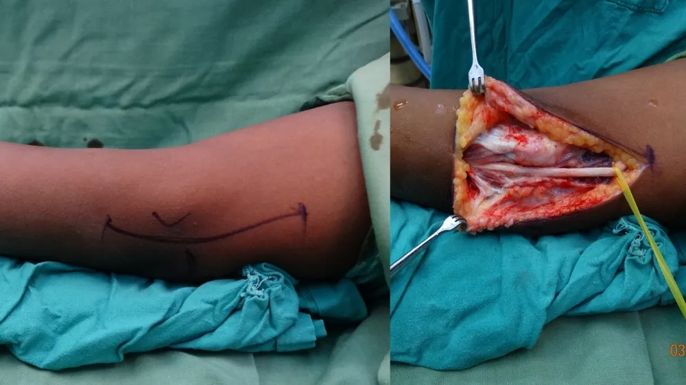 Before surgery
