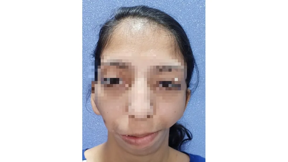 Before surgery