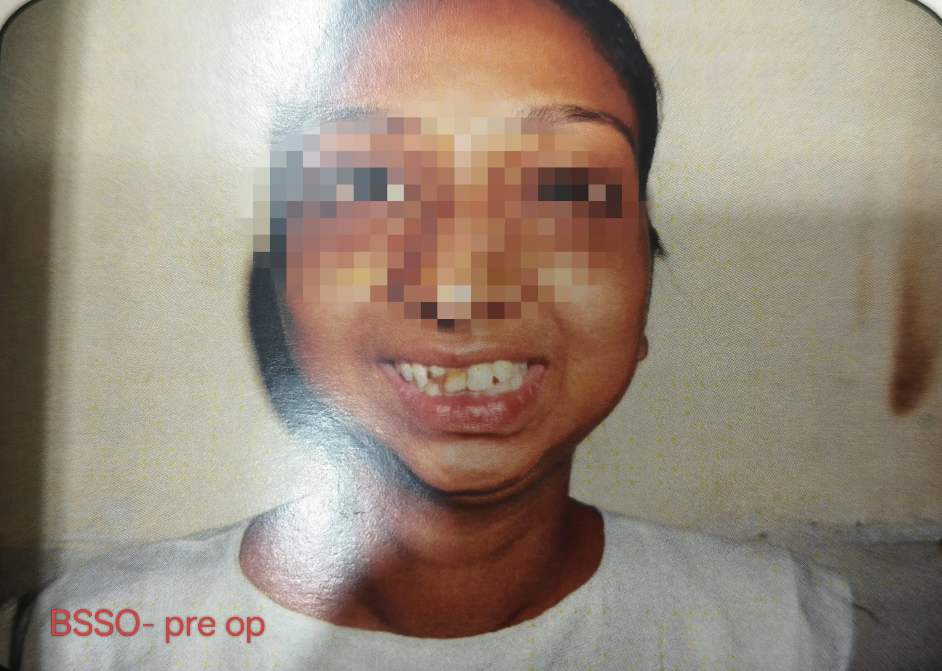 Before surgery
