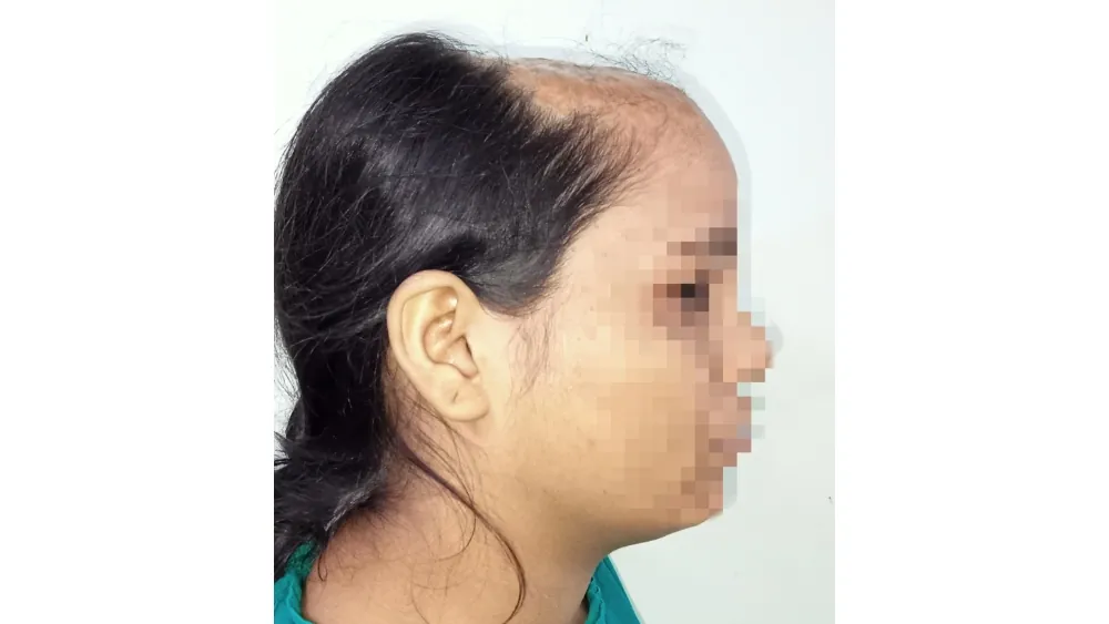 Before surgery