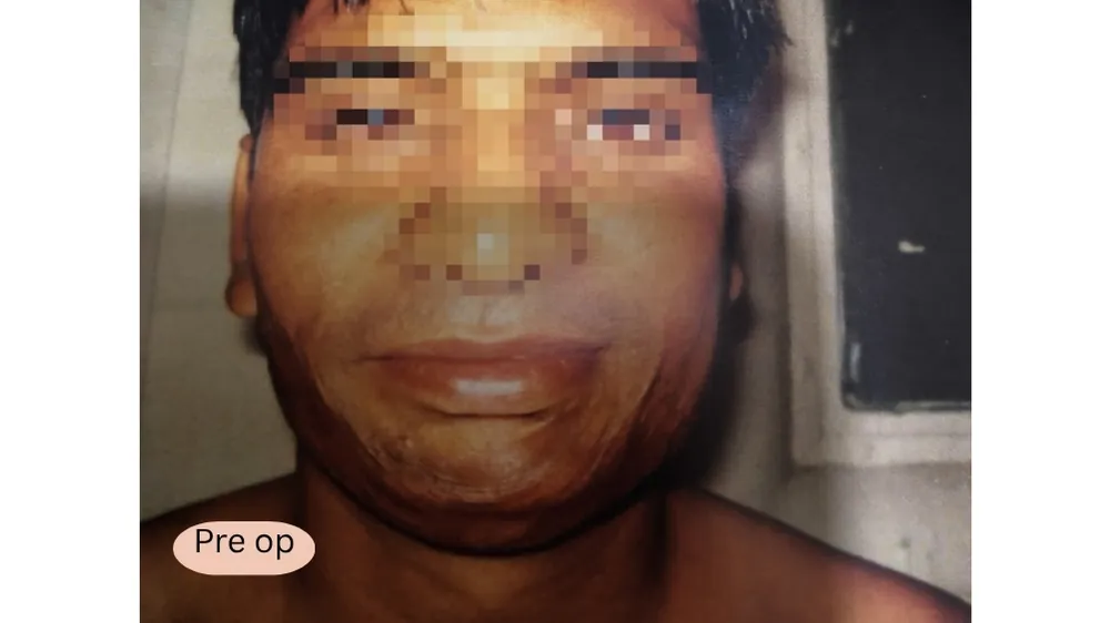 Before surgery