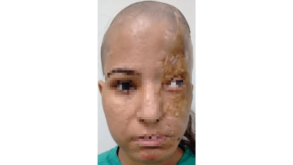 Before surgery