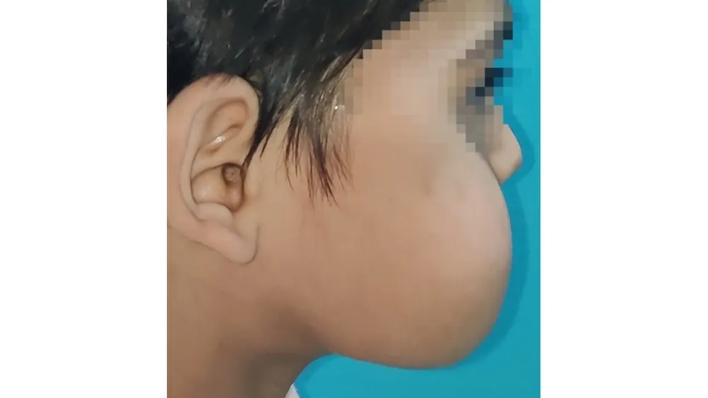 Before surgery