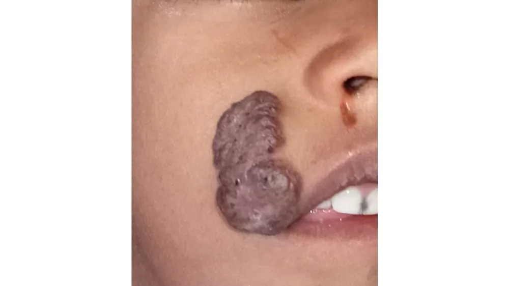 Before surgery