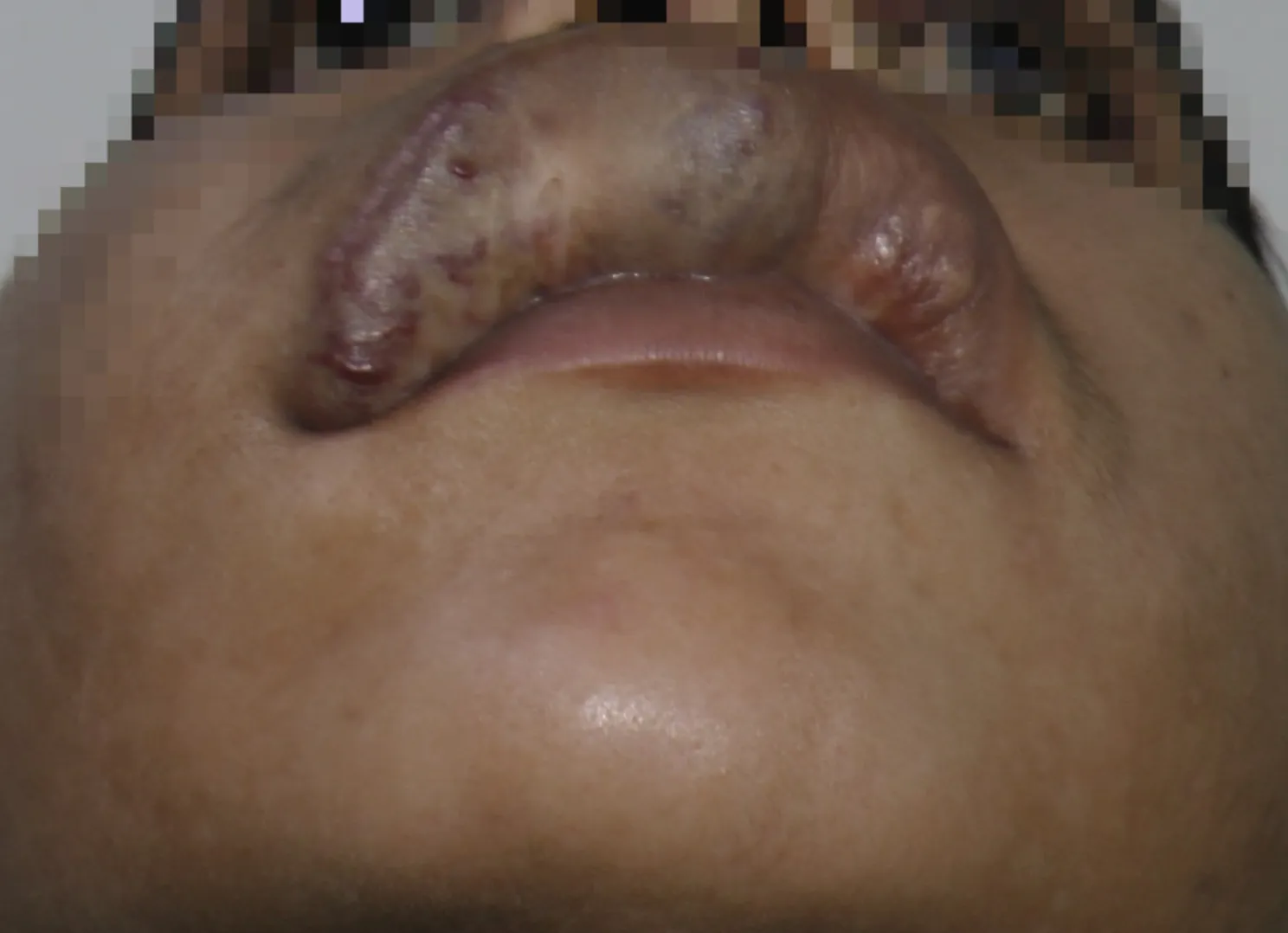 Before surgery