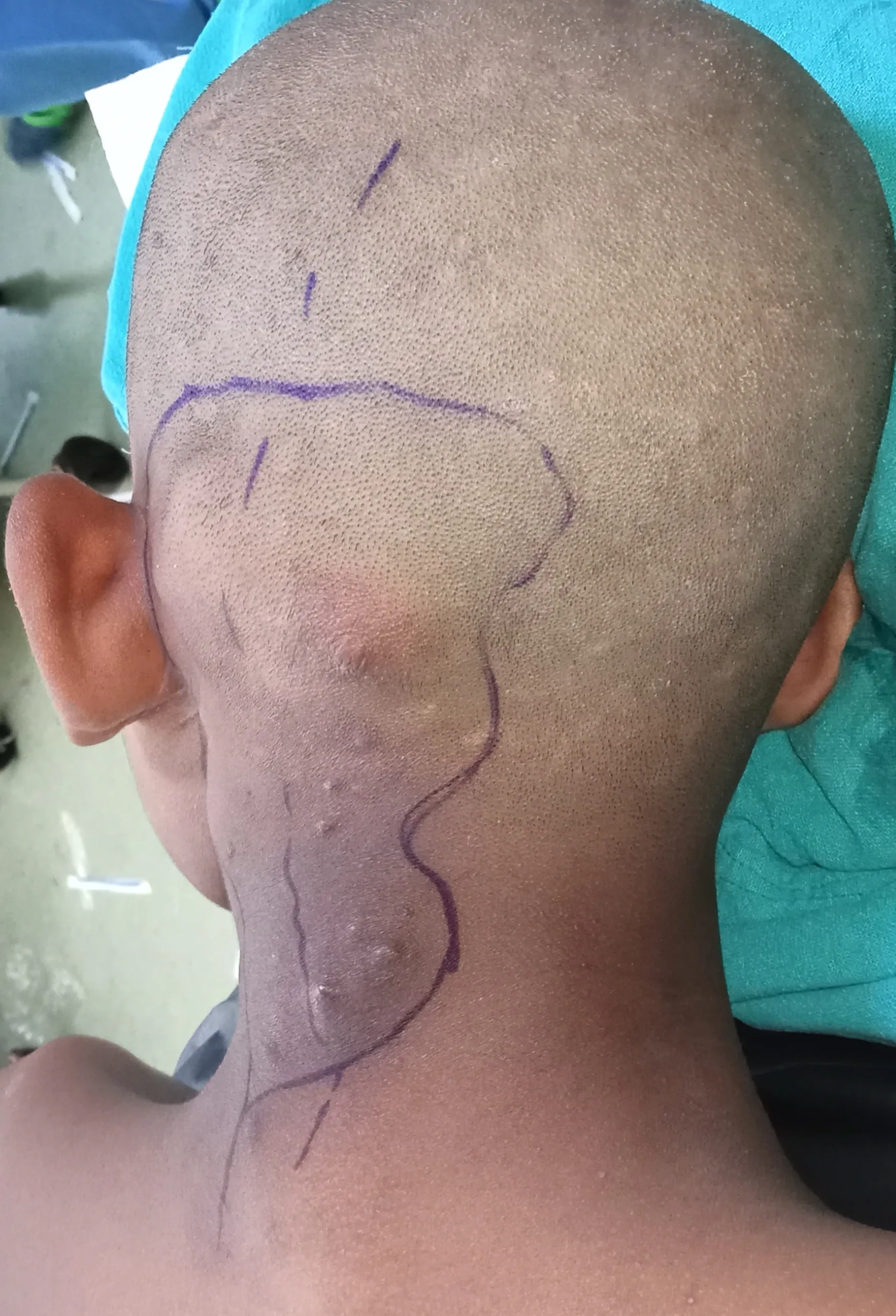 Before surgery