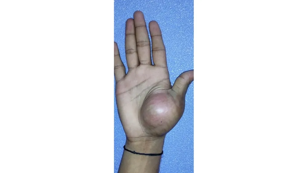 Before surgery