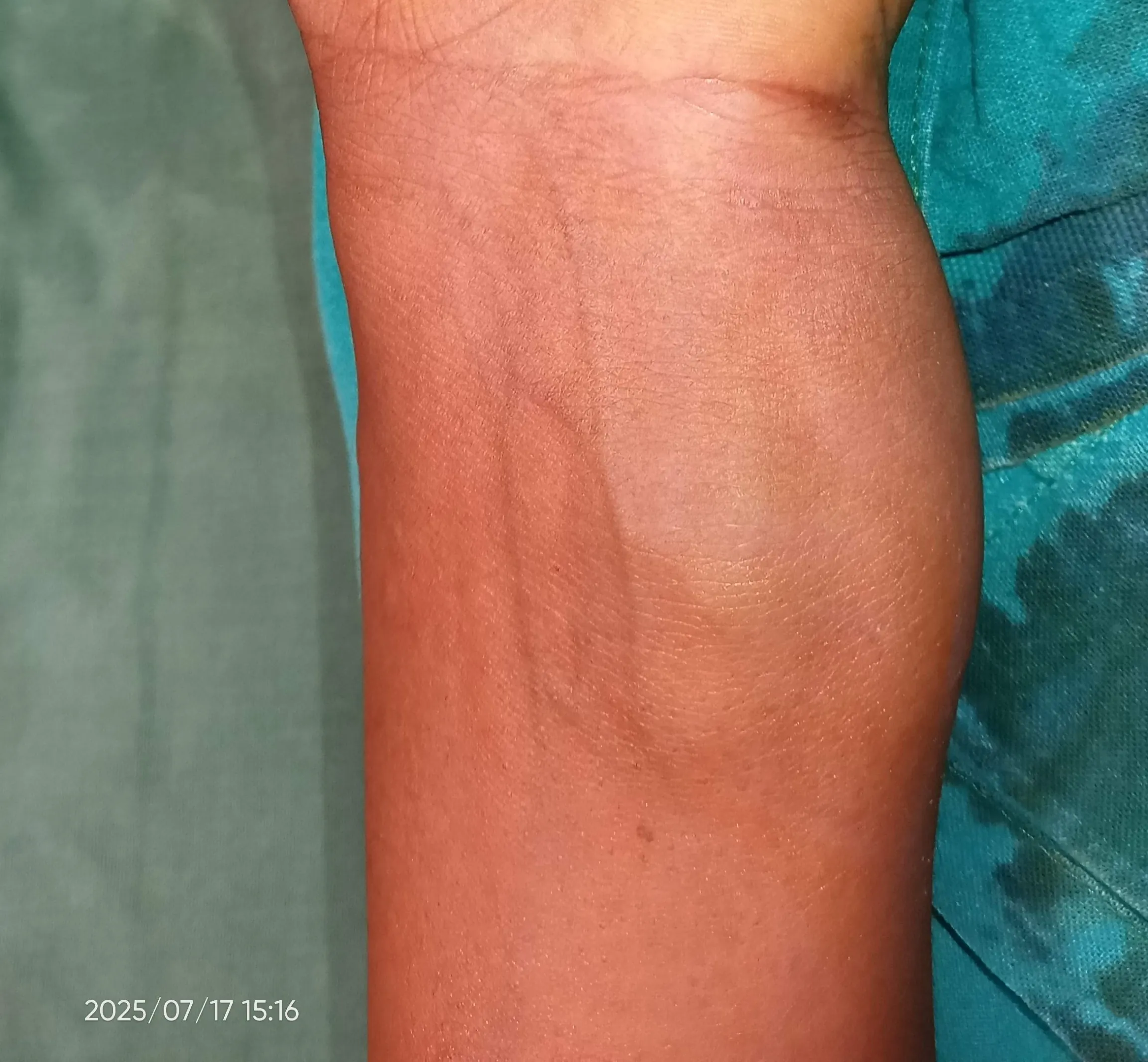 Before surgery