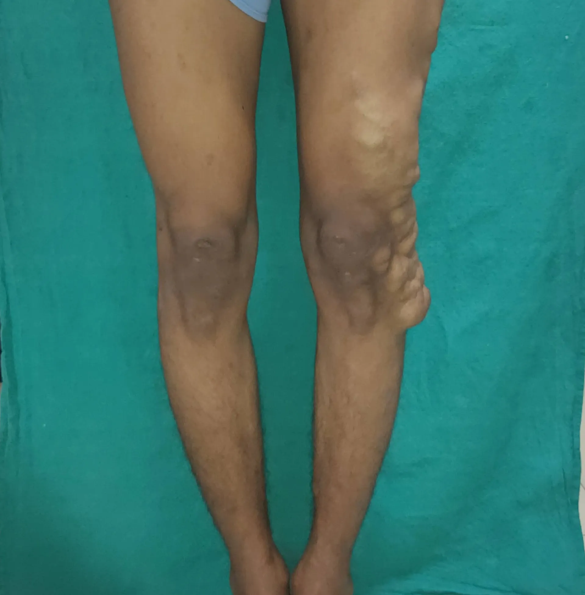 Before surgery