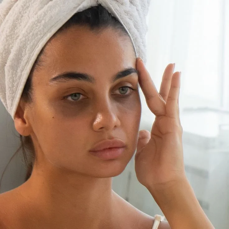 Dark Circles Treatment — hero image