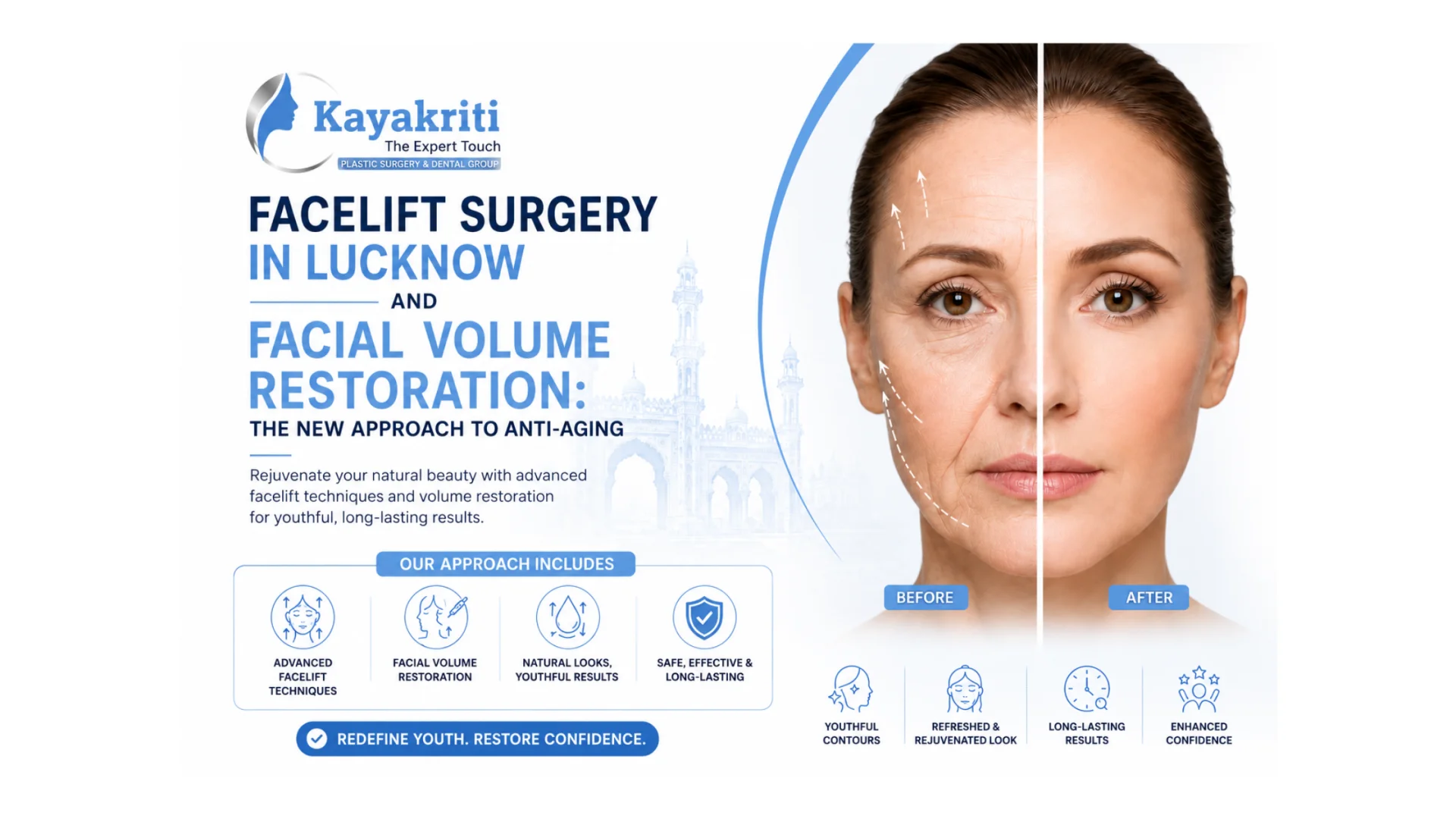 Facelift Surgery in Lucknow and Facial Volume Restoration: The New Approach to Anti-Aging