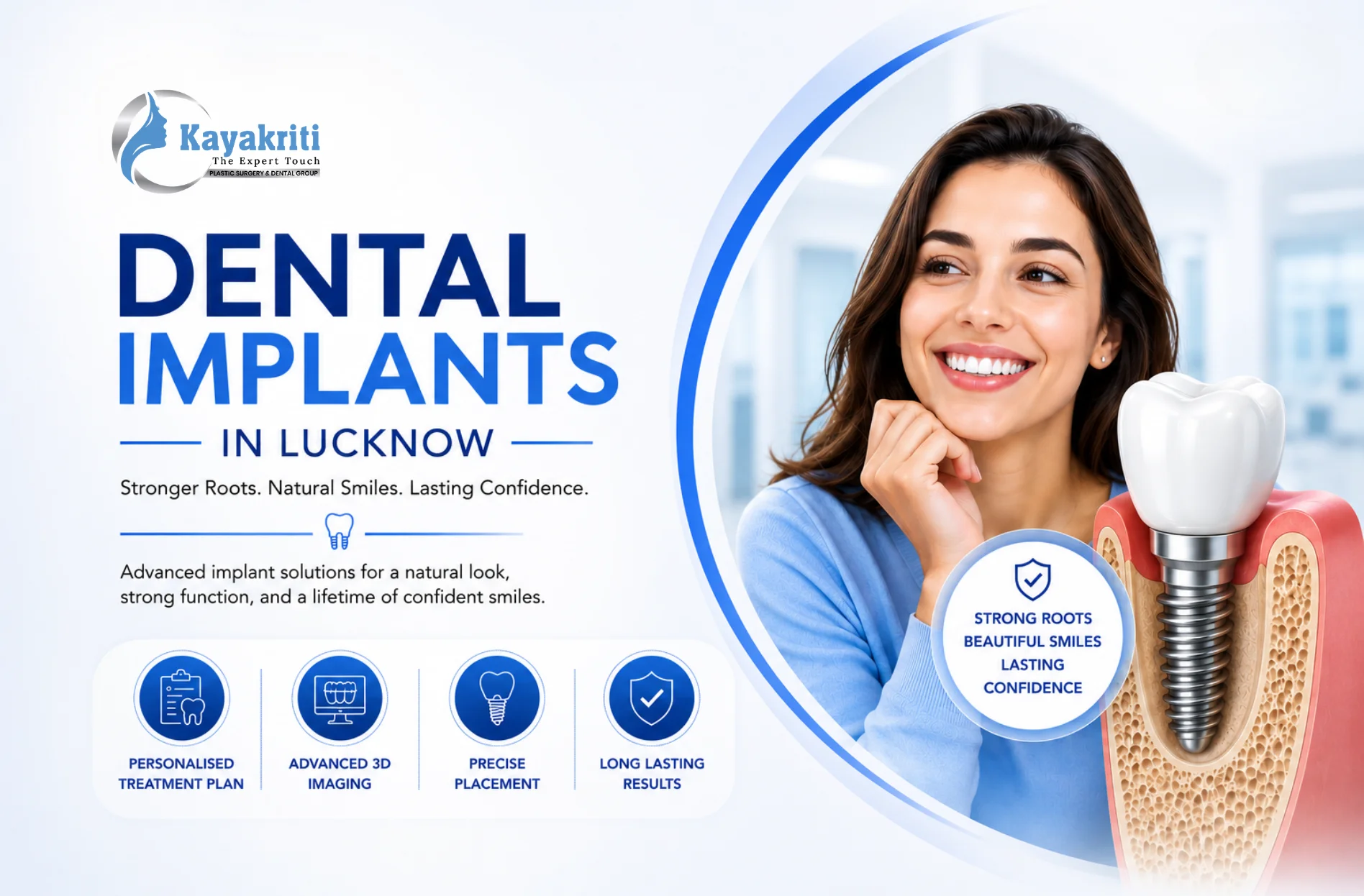 What Makes a Successful Implant Plan? Understanding Personalized Dental Implants in Lucknow