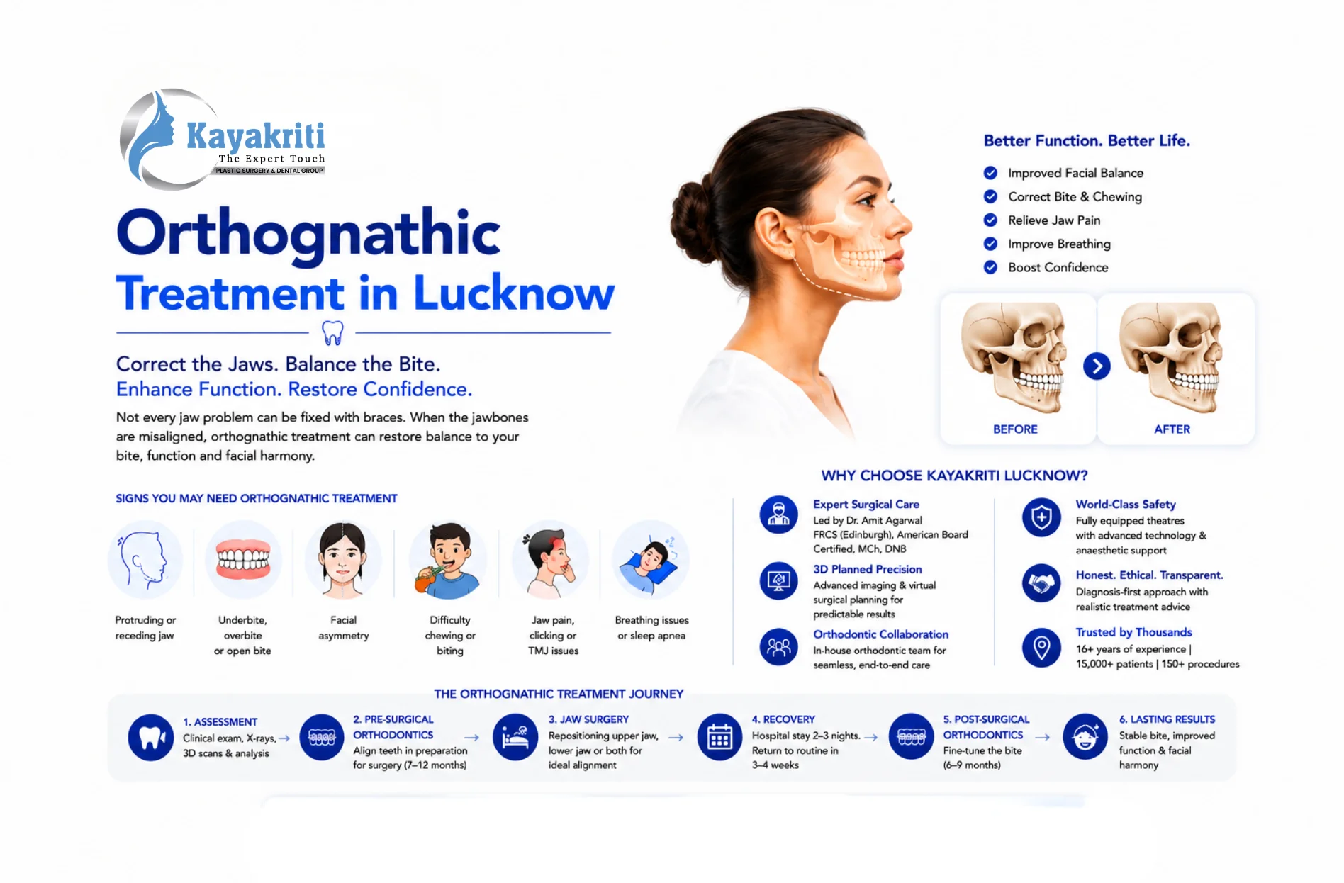 Orthognathic Treatment in Lucknow: How to Know When Corrective Jaw Surgery May Be Needed