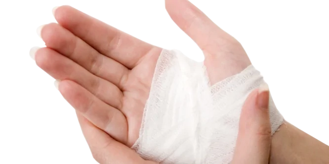 Care-of-burn-patients