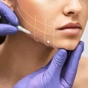 istockphoto-1311229151-612x612 Facial lifting thread. Thread facelift with arrows on face for woman's skin, procedure facial contouring using mesothreads