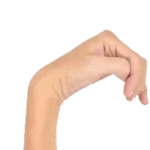 Cerebralpalsy-hand-deformities