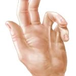 ds00732_im01142_ans7_dupuytrensthu_jpg