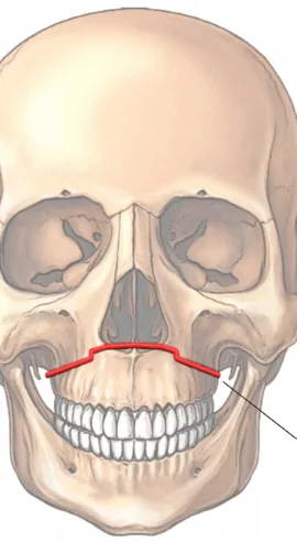 maxillary-le-fort-illustration-92a268