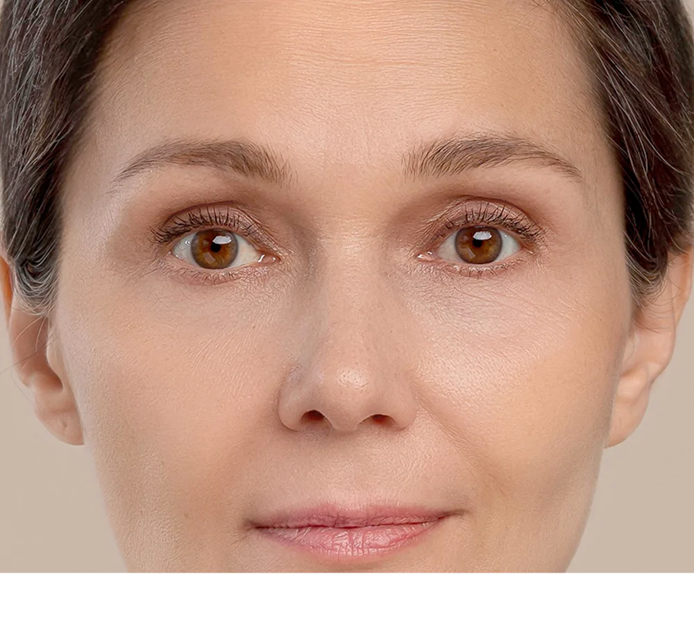 wrinkles-after_image