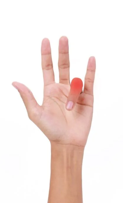 Trigger Finger (2) Trigger Finger (2)