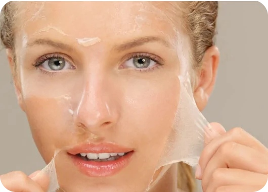 Chemical Peels_ Chemical Peels