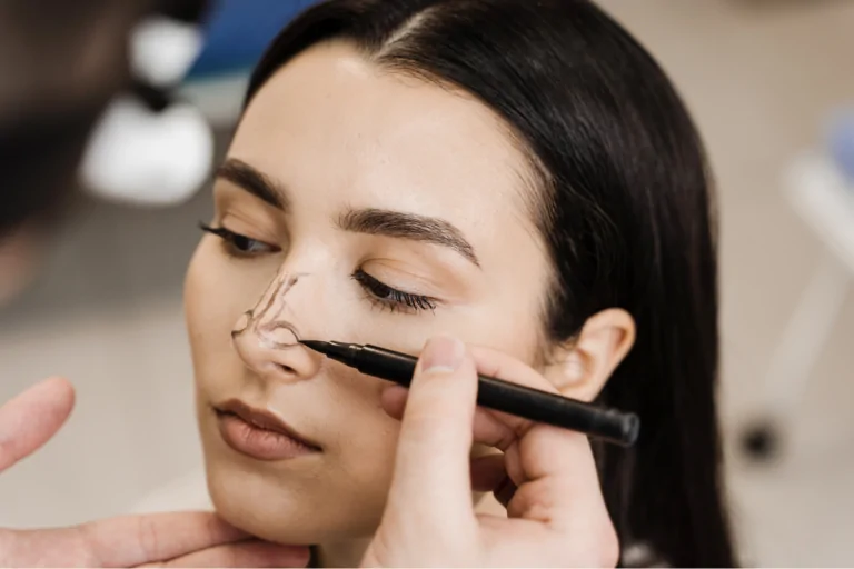 rhinoplasty or nose job patient